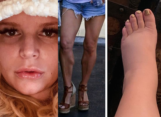 Pregnant Jessica Simpson pokes fun at her swollen foot!