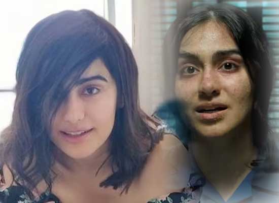 The Kerala Story actress Adah Sharma to share health update post road accident!